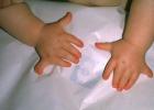 Шестой палец на руке человека Почему ребенок рождается с 6 пальцами